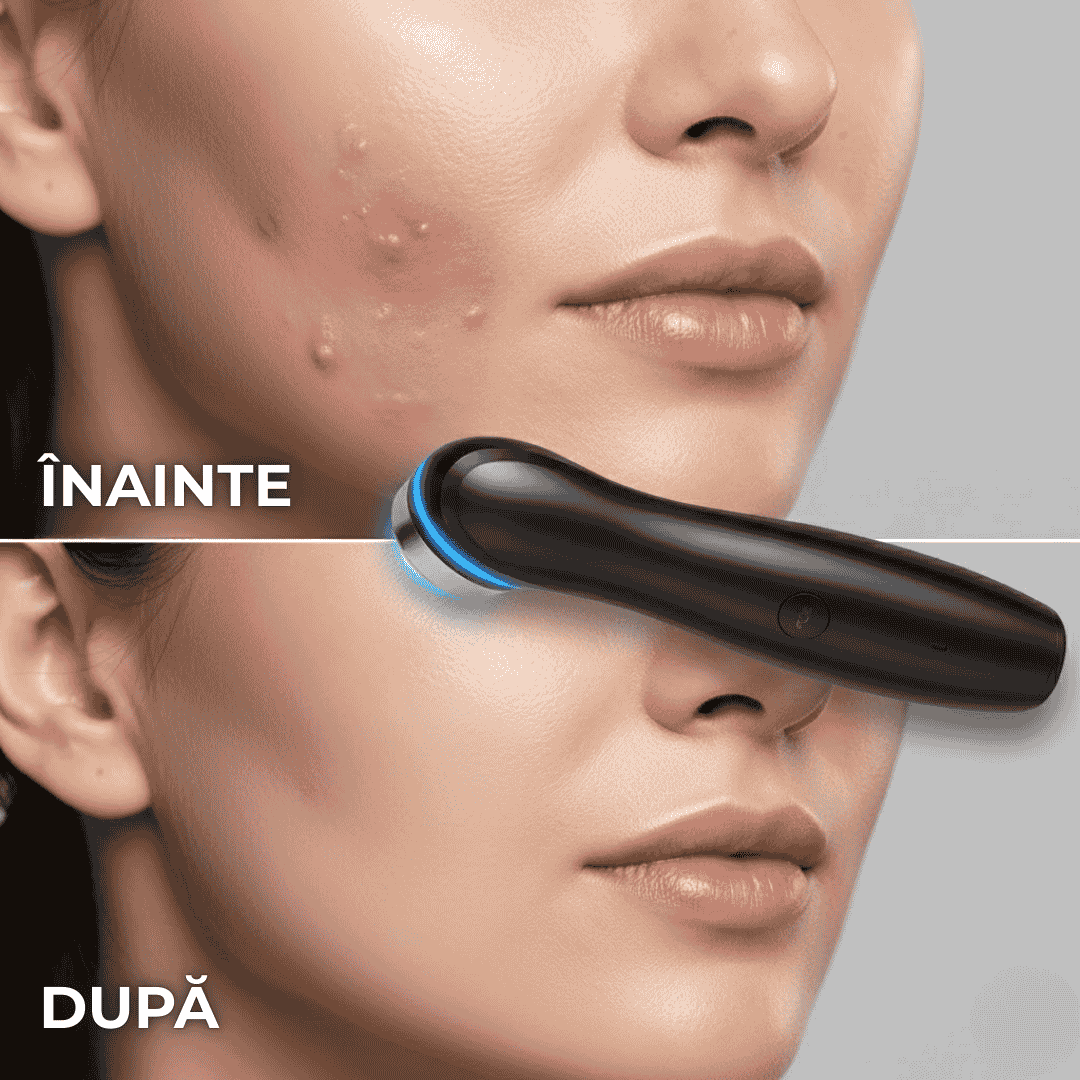 Aparat de Masaj Facial 6 in 1, Tratament Facial Acasa