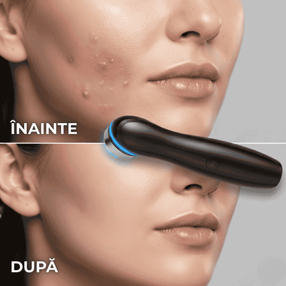 Aparat de Masaj Facial 6 in 1, Tratament Facial Acasa